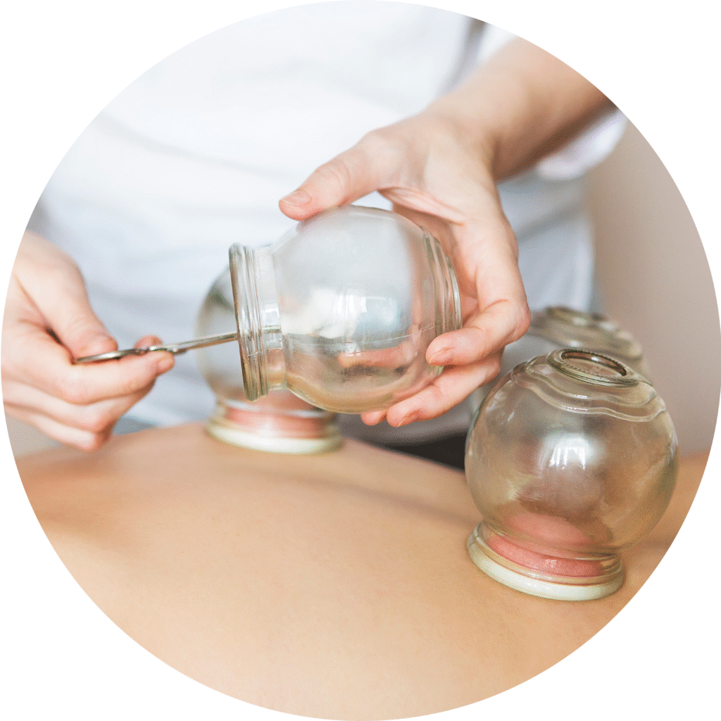 Cupping